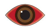 red eyes